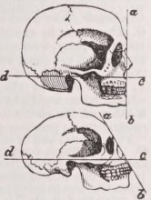 Facial
