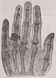 Radiograph