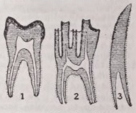 Tooth